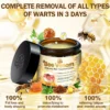 HAM™ Bee Venom Mole and Wart Treatment Cream