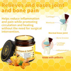 Lotmay™ Bee Venom & Turmeric Arthritis Treatment Cream